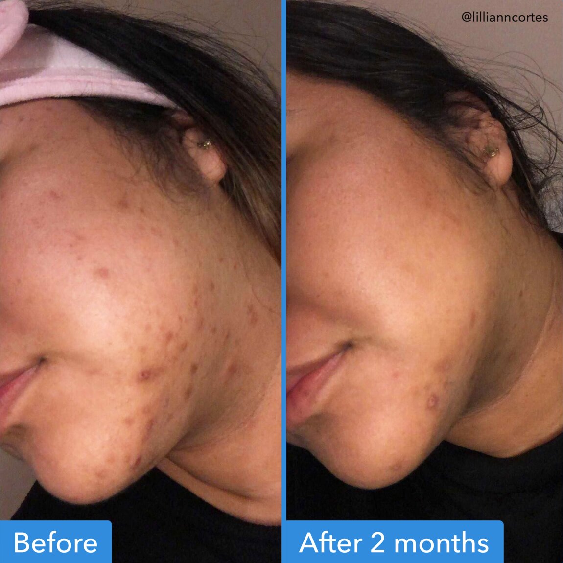 discoloration-correcting-serum-i2 zb_p.jpg