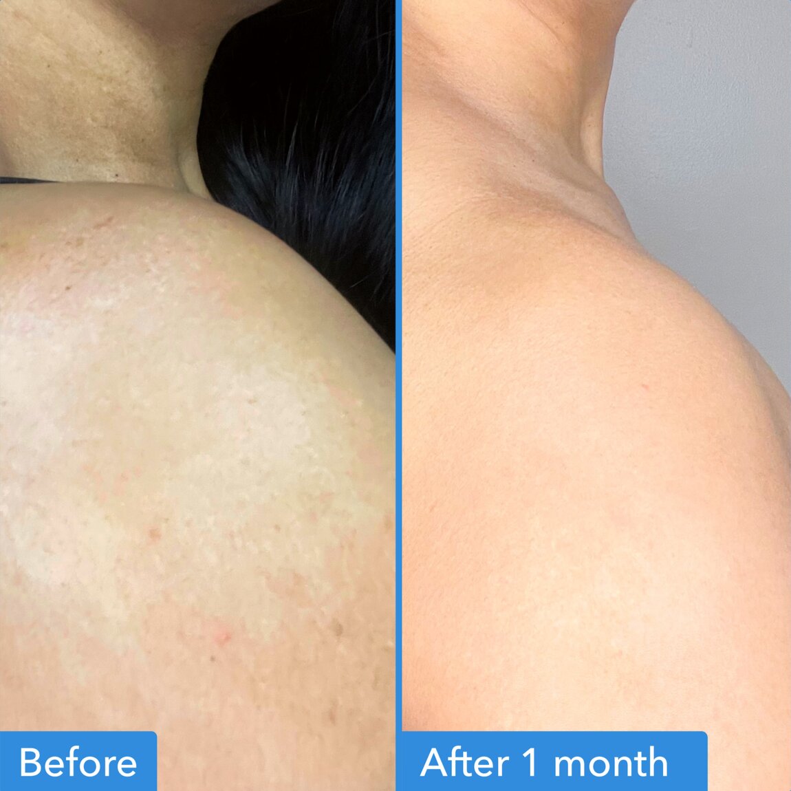 discoloration-correcting-body-treatment-u6 zb_p.jpg